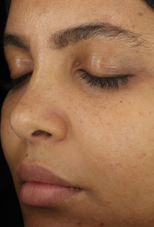 Complexion Clarifying Serum